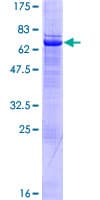 Human SETMAR Protein (Recombinant GST)