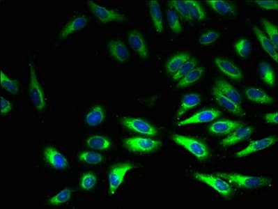 IHC-plus™ CYB5R3 / B5R Antibody