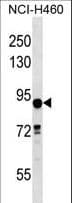 DLEC1 / DLC1 Antibody (aa263-292)