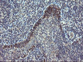 TSC22D1 / TSC22 Antibody (clone OTI4H8)