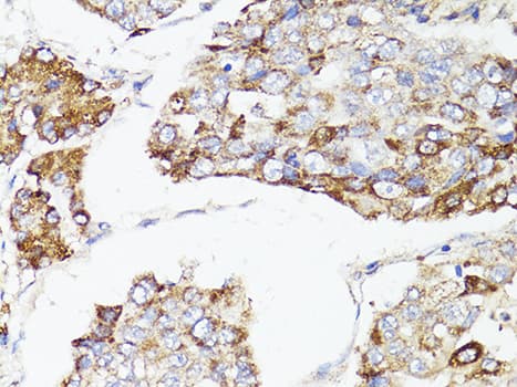 MTOR Antibody