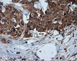 TPMT Antibody (clone OTI2A2)