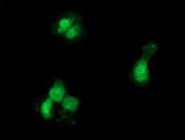 GCKR Antibody (clone OTI1E7)