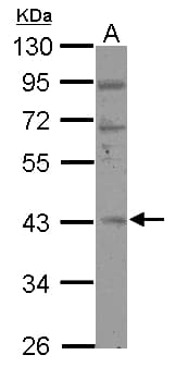 RBM4B Antibody
