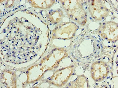 APP / Beta Amyloid Precursor Antibody (aa18-249)