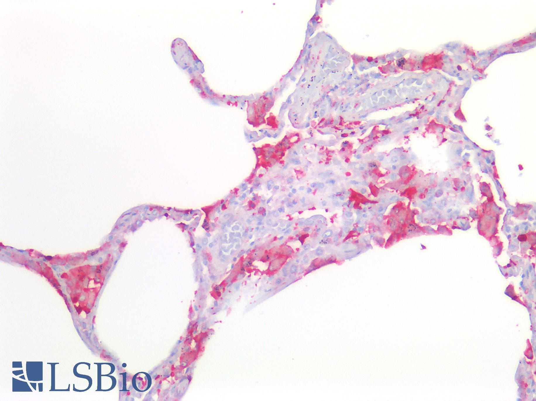Polyclonal Rabbit anti-Human FTL / Ferritin Light Chain Antibody (IHC, WB)