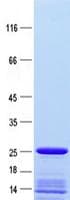 Human TOP1 / Topoisomerase I Protein (Recombinant ABP-His, N-terminus)
