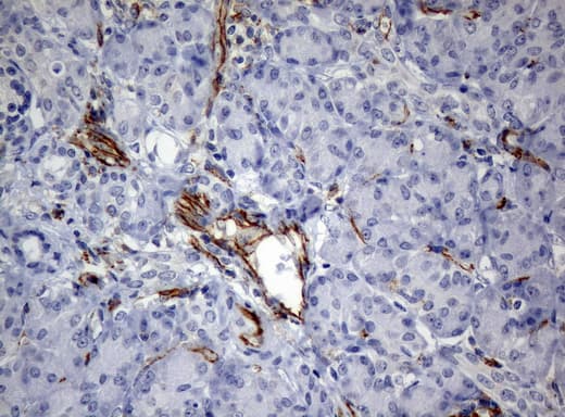 PECAM-1 / CD31 Antibody (clone UMAB32, Carrier-free)