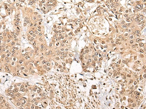 NCAPH / CAP-H Antibody