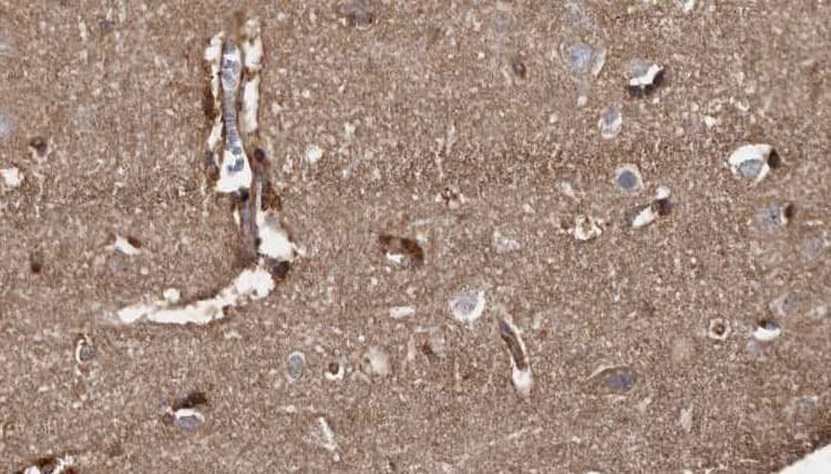 B4GALT7 Antibody