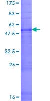 Human CLDN16 / Claudin 16 Protein (Recombinant GST)