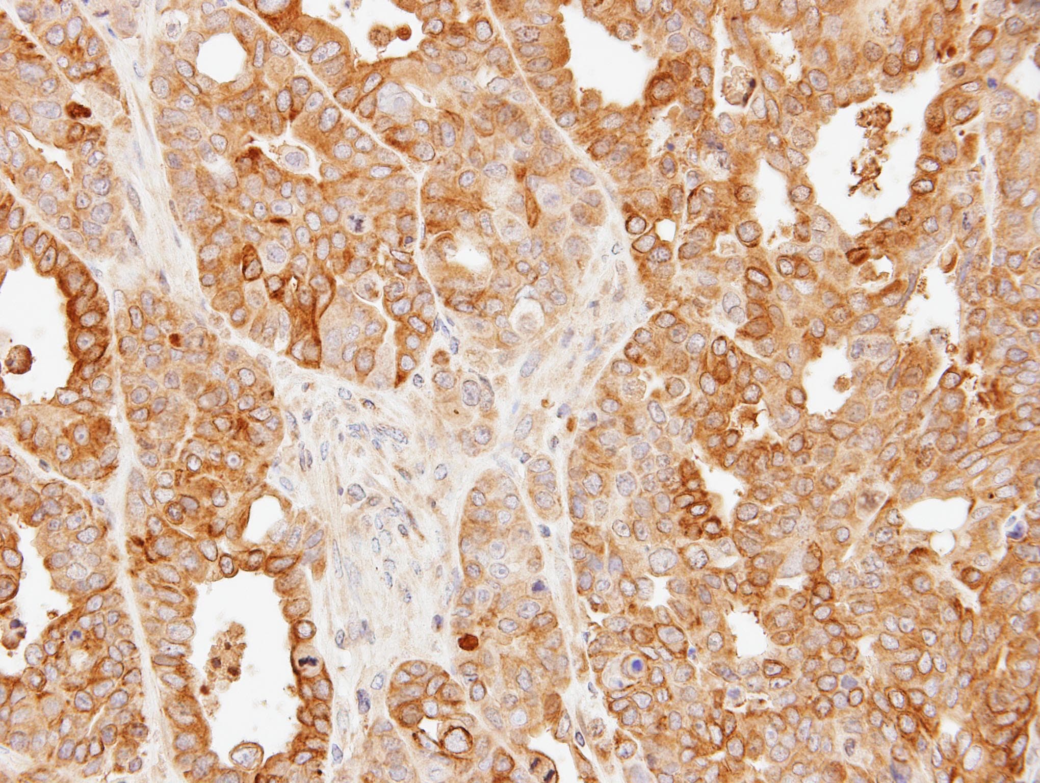SLC25A13 / CITRIN Antibody (aa248-535)