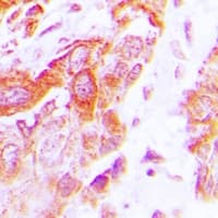 DARS2 Antibody