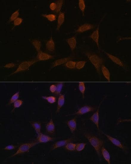 NDUFA5 Antibody