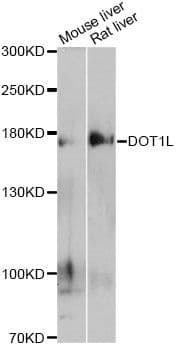 Polyclonal Rabbit anti-Human DOT1L / DOT1 Antibody (WB)
