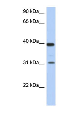 RPSA / Laminin Receptor Antibody (aa107-156)