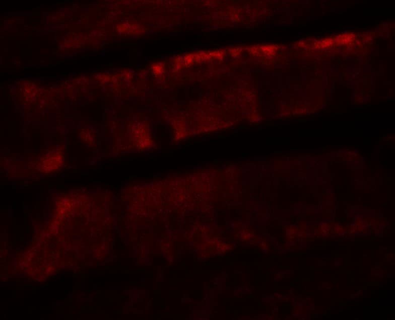 IHC-plus™ Polyclonal Rabbit anti-Human ADORA2B/Adenosine A2B Receptor Antibody (IHC, IF, WB)