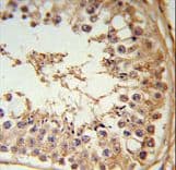 FBXL5 / FBL5 Antibody (aa86-115)