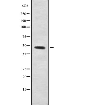 Polyclonal Rabbit anti-Human STAP2 Antibody (WB)