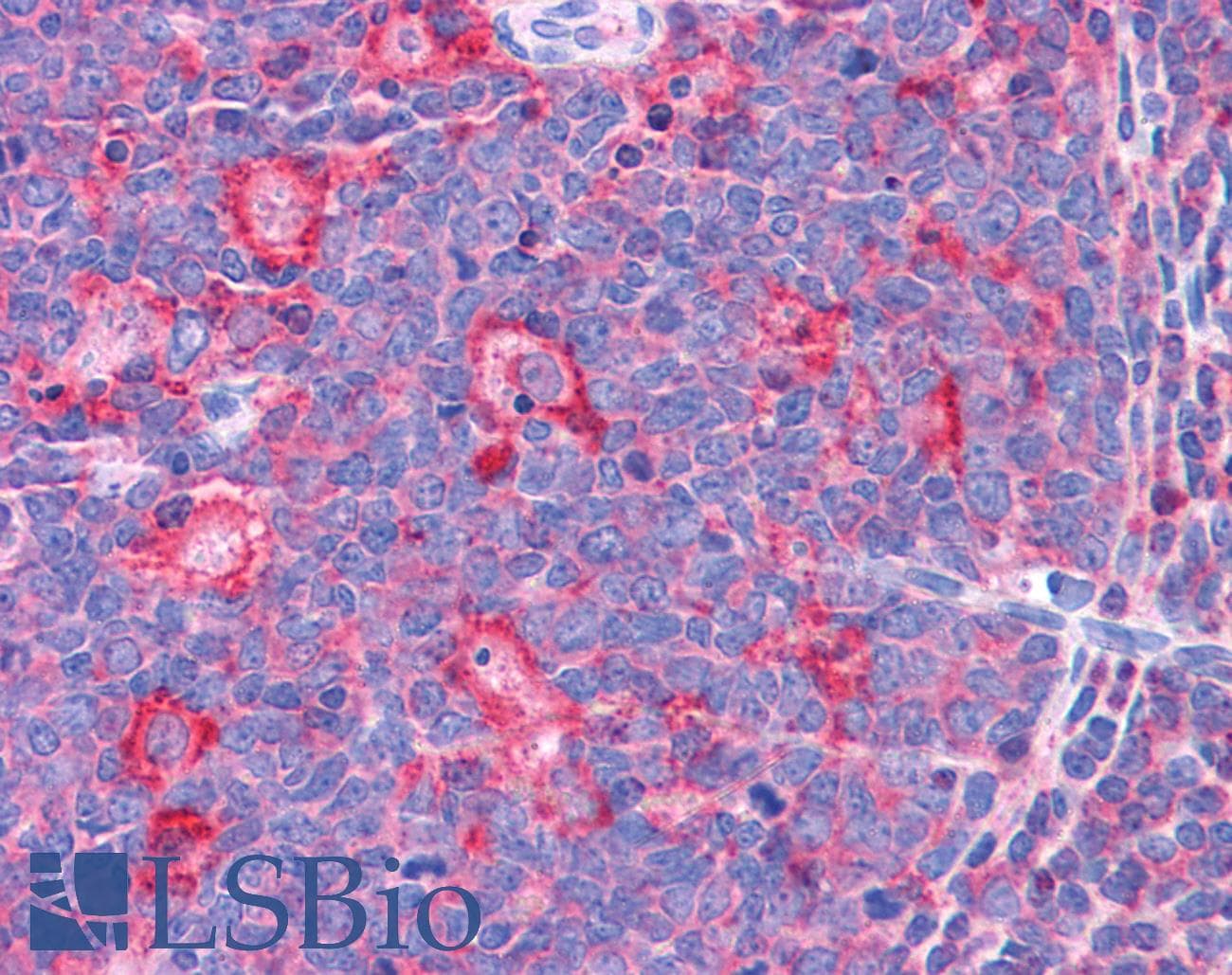 IHC-plus™ Polyclonal Goat anti-Human TPD52L2 / HD54 Antibody (aa195-205, IHC, WB)