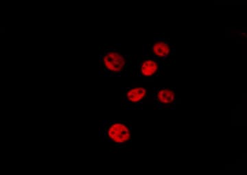 HDAC5 Antibody (phospho-Ser259)