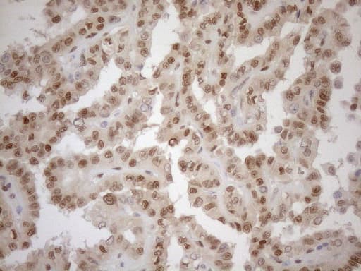 MGMT Antibody (clone OTI6C4)