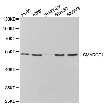 SMARCE1 / BAF57 Antibody