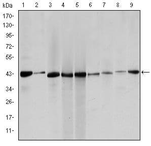 Monoclonal Mouse anti-Human ACTA2 / Smooth Muscle Actin Antibody (clone 1H8, IF, WB)