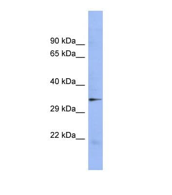 STAU2 Antibody (aa171-220)