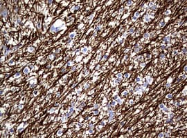 NF-L / NEFL Antibody (clone OTI3G2)