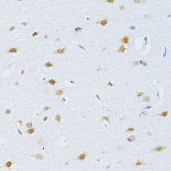POLR2A / RNA polymerase II Antibody