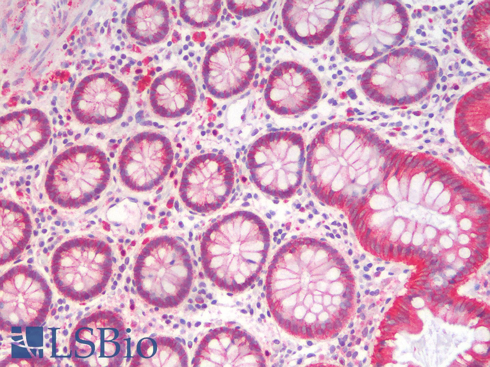 PathPlus™ Polyclonal Rabbit anti-Mouse CTNNB1 / Beta Catenin Antibody (IHC, IF, WB)