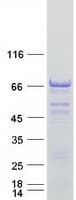 Human PEX5L Protein (Recombinant Myc-DDK (Flag))