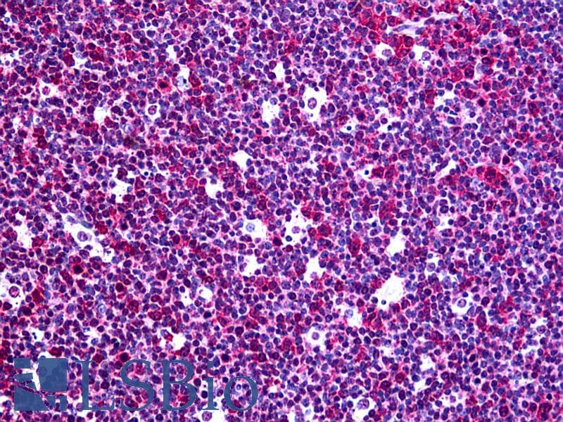 IHC-plus™ Monoclonal Mouse anti-Human RGS3 Antibody (clone 1E8-C7, IHC, IF, WB)