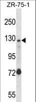 E4 / UBE4A Antibody (aa451-479)