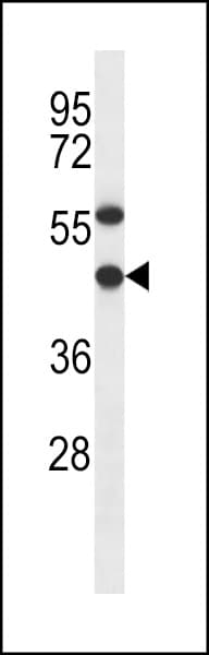Polyclonal Rabbit anti-Human EBNA1BP2 Antibody (aa271-302, WB)