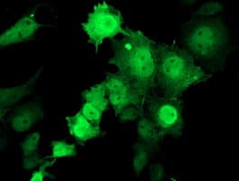 TMOD1 / Tropomodulin 1 Antibody (clone OTI1F2)