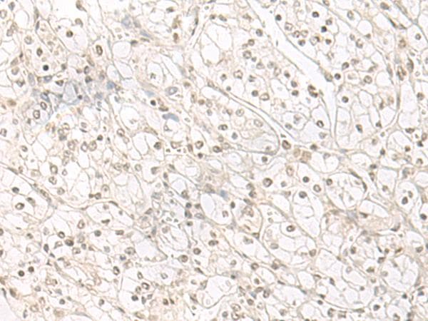 HENMT1 Antibody