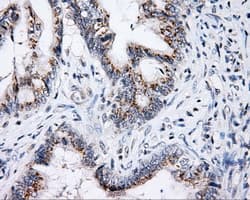p66 / SHC Antibody (clone OTI1H8)