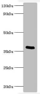 Pertussis Toxin Antibody (aa35-269)