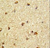 Polyclonal Rabbit anti-Human CBFB Antibody (aa61-90, IHC, IF, WB)