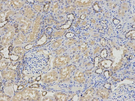 Polyclonal Rabbit anti-Human RRM2 Antibody (IHC, IF, WB)