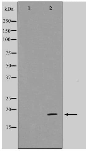 CDK2AP1 / DOC1 Antibody
