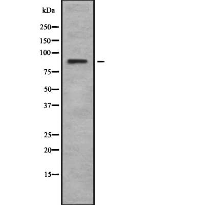 RPS6KA6 / RSK4 Antibody