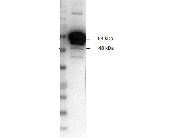 Pyruvate Kinase Antibody (Lyophilized, Biotin)