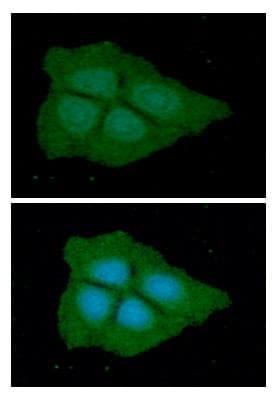 PGD Antibody (clone AT46B3)