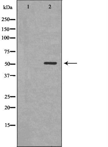 CLU / Clusterin Antibody