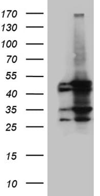 MCAD / ACADM Antibody (clone OTI10A5)