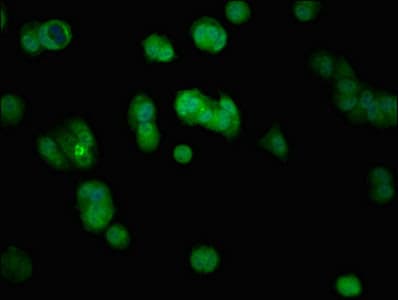 KRT5 / CK5 / Cytokeratin 5 Antibody