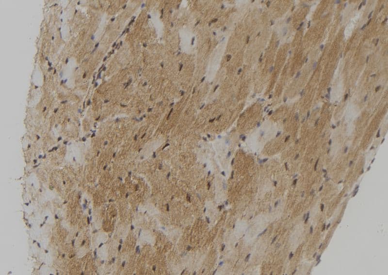 Polyclonal Rabbit anti-Human TMPRSS4 Antibody (IHC, IF, WB)